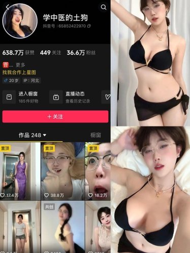 学中医的土狗 – 微密圈写真&视频合集【持续更新中】